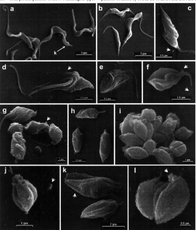 Fig. 1: scanning electron micrograph of Trypanosoma cruzi during the extracellular transformation of trypomastigotes to amastigote in MEMTAU medium at 37°C
