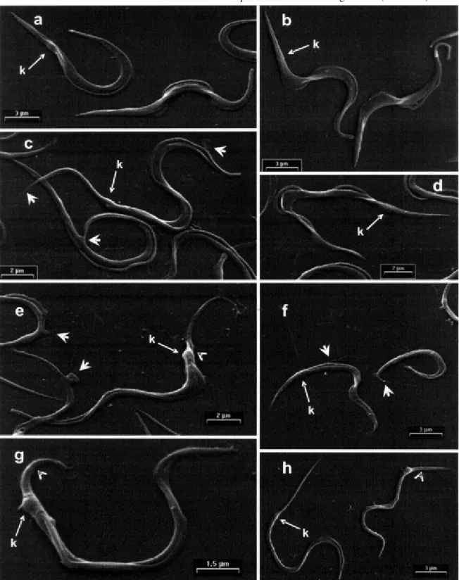 Fig. 2: scanning electron micrograph of Trypanosoma cruzi during the extracellular transformation of metacyclic forms to amastigotes.