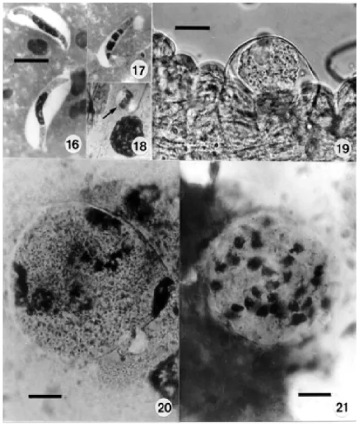 Figs 16-21: development of Hepatozoon caimani  in the mosquito Culex fatigans. Fig. 16: freed gametocytes in a Giemsa-stained smear of the intestine and contained blood, 3 h after the blood-meal