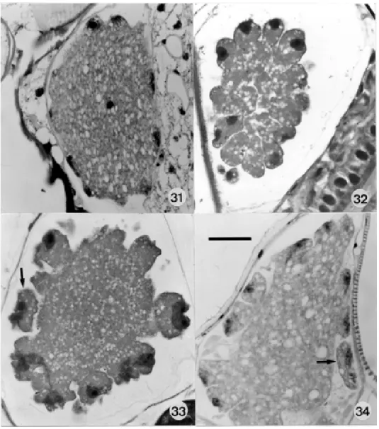 Figs 31-34: asynchronous sporogonic development of  Hepatozoon caimani in a single Culex fatigans, 13 days after the blood-meal