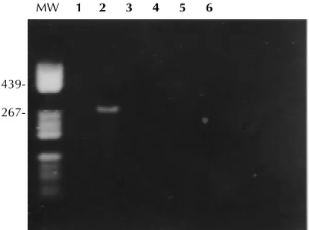 Fig. 1:  specificity of the polymerase chain reaction for other respiratory viruses. Position of samples on the gel - 1:  nasopha-ryngeal exudate from an asymptomatic patient