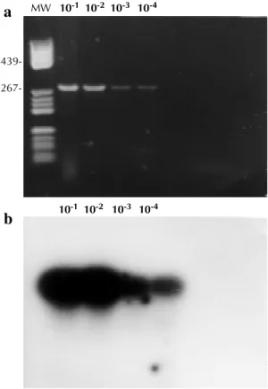 Fig. 2. a: sensitivity of detection of respiratory syncytial virus (“Long” strain) by polymerase chain reaction (PCR)