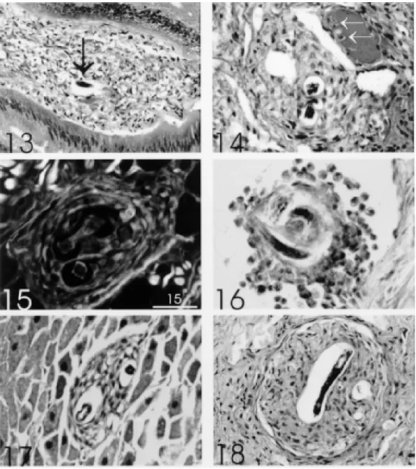 Fig. 13: non organoid scattered reaction of amebocytes around L 1  (arrow) in subepthelial connective tissue of copulation purse (time of infection: 8 hr) (HE, 310x)