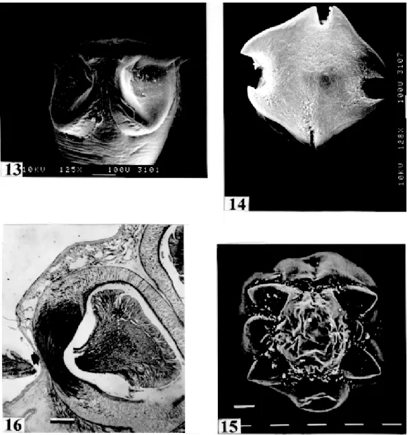 Fig. 13: Harriscolex kaparari. SEM. Suckers with projections and a cornified domus (arrows)