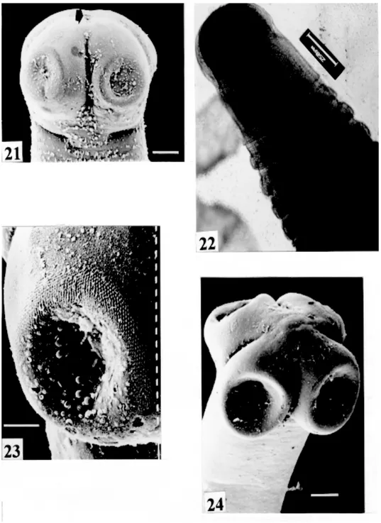 Fig. 21: Nomimoscolex piraeeba. SEM. Opening of apical gland (arrow). Scale bar = 0.100 mm