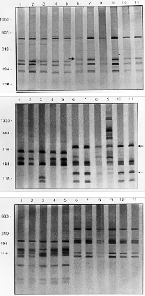 Fig. 2: silver stained polyacrylamide gels 6% or 8% showing the PCR and RFLP profiles obtained following the  digestion of the rDNA internal transcribed spacer region with AluI (A), MnlI (B) and HaeIII (C)
