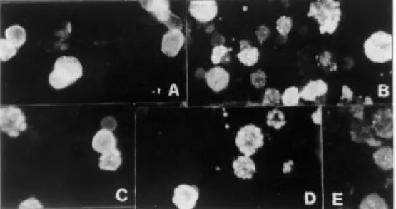 Fig. 1: Sf9 cells expressing VP1 or VP2, as mesured by IFA using standard human serum - IgG anti-B19 (100 u.a