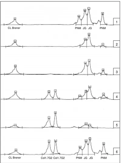 Fig. 2: microsatellite profile electrofluorogram with SCLE10 locus of parasites recovered from triatomine feces artificially infected with monoclonal Trypanosoma cruzi populations