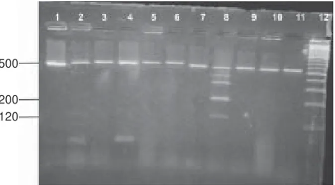 Fig. 3: restriction digestion of polymerase chain reaction products of Candida clinical isolates with the enzyme BfaI