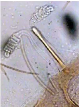 Fig. 4: Nyssomyia neivai  ♀ : spermatheca (400X)