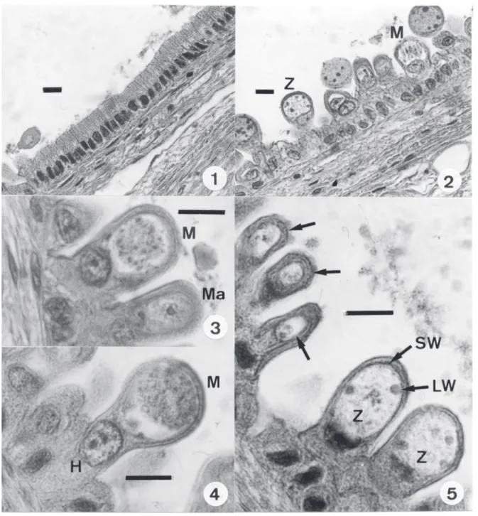 Figs 1-5: Choleoeimeria amphisbaenae n. sp.  in the gall-bladder epitheliium of the lizard Amphisbaena alba