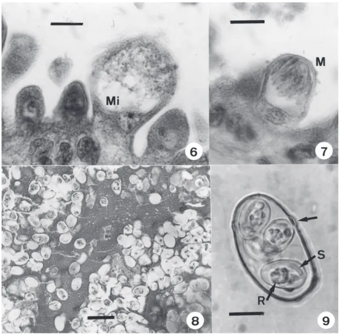 Figs 6-9. Choleoeimeria amphisbaenae n. sp. in the gall-bladder epithelium of the lizard Amphisbaena alba