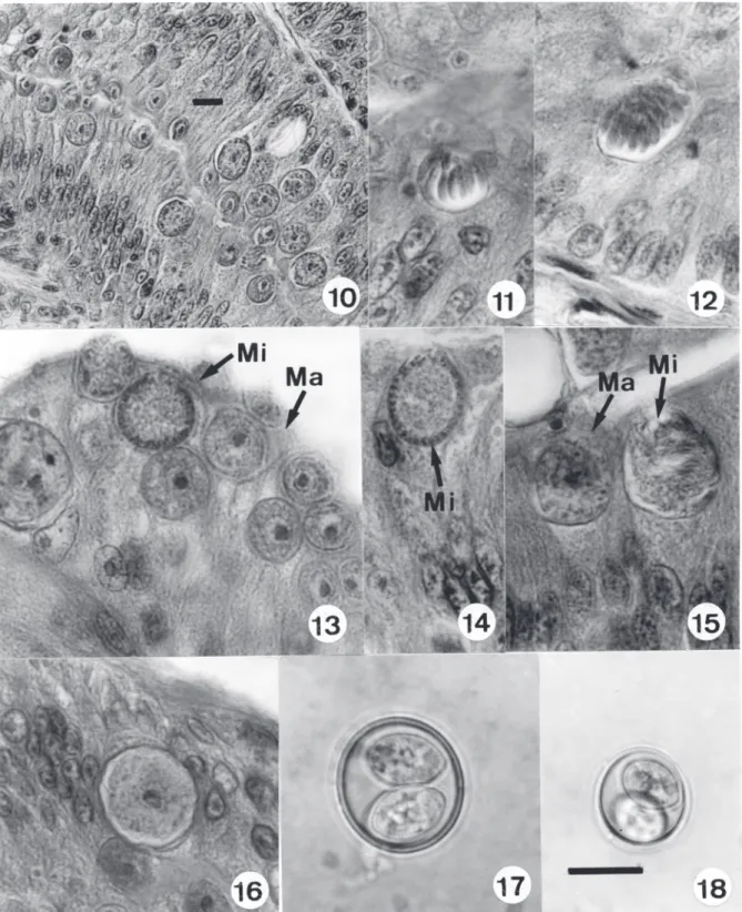 Figs 10-18. Isospora capanemaensis n. sp. in the ileum epithelium of the lizard Amphisbaena alba