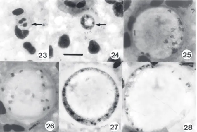Figs 23-28. An unidentified parasite in the kidney of the lizard Amphisbaena alba. Figs 23, 24:  young intracellular and extracellular forms with 3-6 nuclei (arrowed)