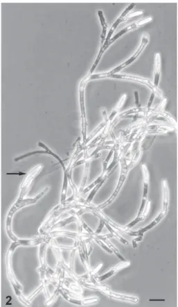 Fig. 2: Genistellospora tropicalis. Entire thallus removed from a Simuliidae larva hindgut bearing trichospores and one zygospore (arrow)