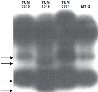 Fig. 2: restriction fragment length polymorphism analysis and south- south-ern blot detection showing the two different pattsouth-erns obtained by digestion with  Dde I