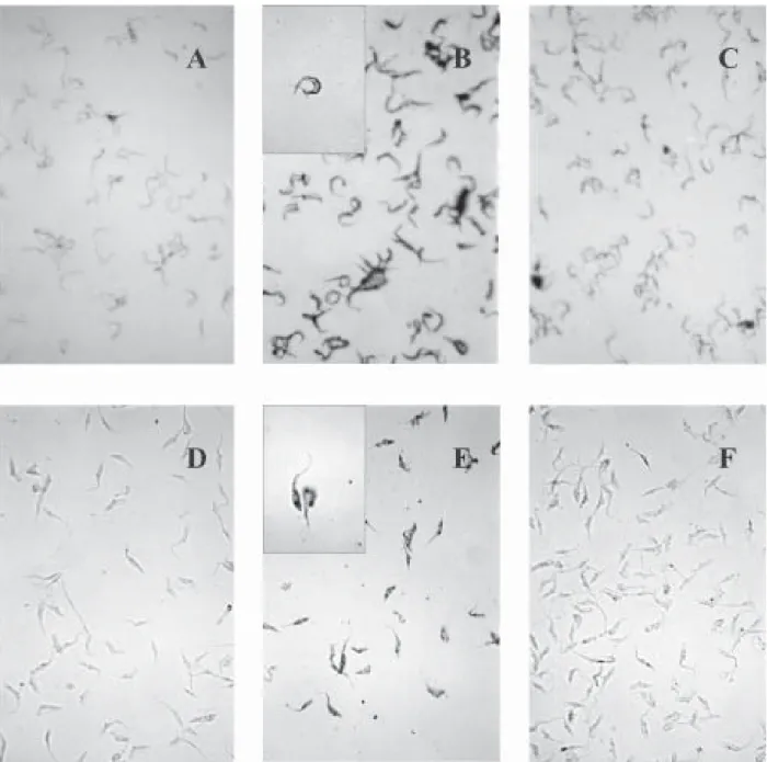 Fig. 1: plasminogen immunostaining of plasminogen treated Trypanosoma cruzi. Living parasites were incubated with 2 µM plasminogen in the presence or absence of ε-aminocaproic acid