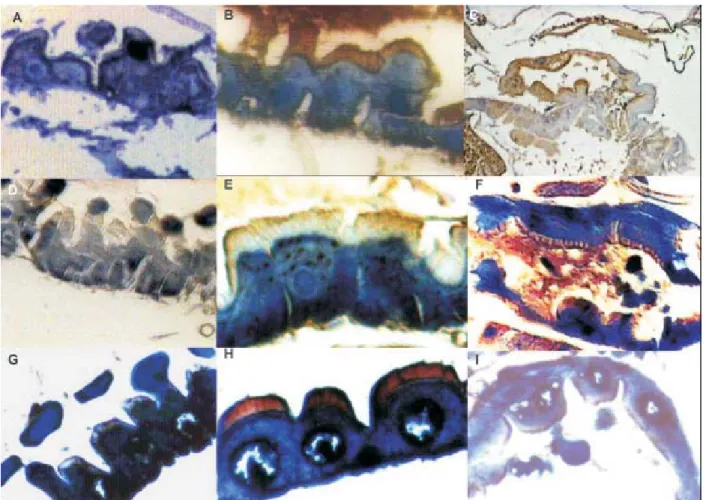 Fig. 2: immunohistochemical localization of the Cry11Bb toxin of Bacillus thuringiensis subsp