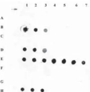 Fig. 2: dot-blot hybridization. B1-3, D1-3, and E1-3, samples from B19-DNA-positive patients (undiluted and diluted up to 10 -2 );  H1-3, positive donor plasma BrIII (Cruz et al.1989) (undiluted and diluted up to 10 -2 ); E4-7, Diamed-positive donor plasma