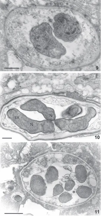 Fig. 12: schematic view of a cyst form where the main structures are indicated.