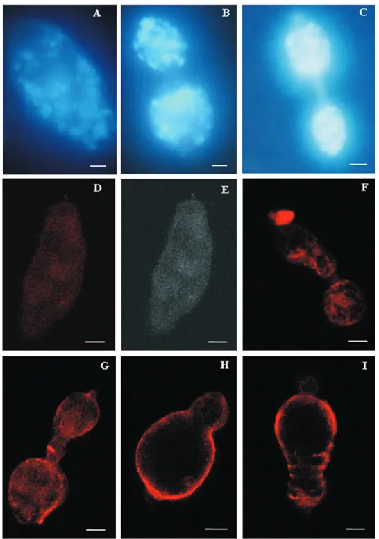 Fig. 2: evaluation of praziquantel (PZQ)  activity on the membrane of in vitro transformed sporocyst