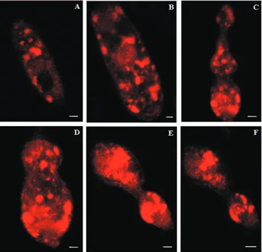 Fig. 3: evaluation of the presence of lysosome-like organelles in sporocyts and the influence of praziquantel (PZQ) on acidic organelles.