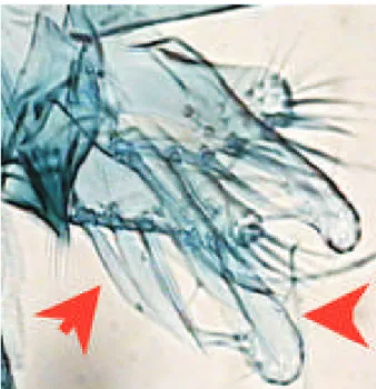 Fig. 3: Lutzomyia (Psychodopygus) claustrei. Arrows showing the digitform appendix of the paramere and the bristles inserted at the principal lobe.