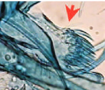 Fig. 7: Lutzomyia (Psychodopygus) ayrozai. Arrow showing the principal lobe of the paramere.