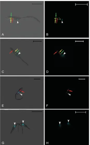 Fig. 4: immunofluorescence co-localization of TRITC-labeled transferrin and flotillin-1 in Trypanosoma cruzi epimastigotes