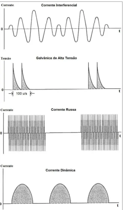 Figura 3.7   Designações “comerciais” de correntes elétricas de estimuladores contemporâneos