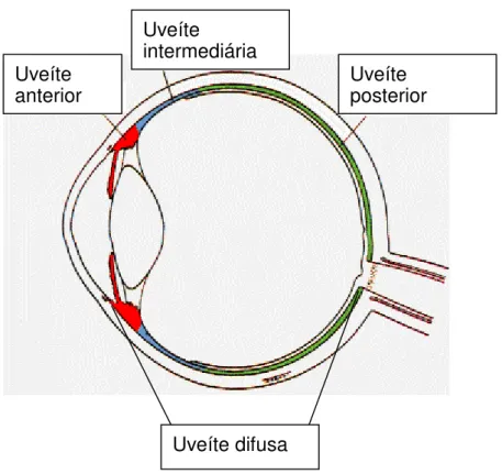 FIGURA 4: Classificação anatômica da uveíte. Fonte: Adaptação de Perret Opticiens (2005)