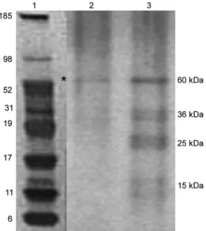 Fig. 7: SDS-PAGE of the outer membrane proteins (OMPs) of Bacte- Bacte-roides fragilis ATCC 43859 strain passed through the affinity column  with  laminin