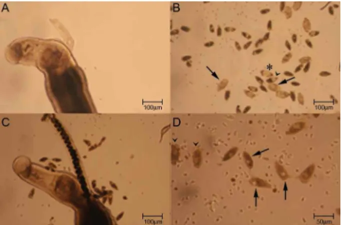 Fig. 2: classification of  S. mansoni eggs by morphological (left) and  fluorescent  microscopy  technique  using  the  proble  Hoechst  33258  (right)