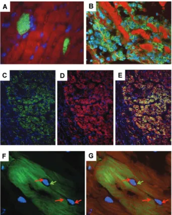 Fig. 1: presence of bone marrow-derived cells (BMC) in the hearts of  chagasic mice. A: heart section of a BALB/c mouse during the acute  phase of infection with Colombian strain Trypanosoma cruzi,  show-ing  parasite  nests  (green);  B:  heart  section  