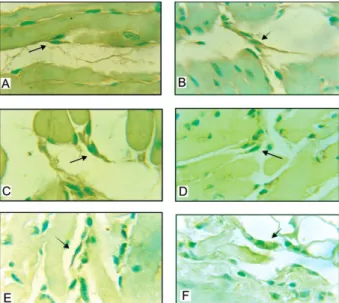 Fig. 5: quantitative evaluation of the number of interstitial dendritic  cells (IDCs) immunolabelled for Trypanosoma cruzi antigens in the  myocardium of mice chronically infected with different strains of T