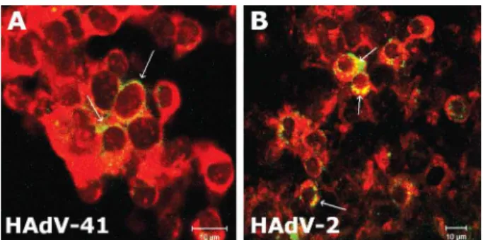 Fig. 2: kinetics of HAdV-41 and HAdV-2 infection in 293 cells. Newly  synthesized viral proteins in the cytoplasm of infected cells (indicated  by arrows) at 24 h of infection, revealed with rabbit polyclonal  anti-serum  to  HAdV-41  (A)  and  rabbit  pol