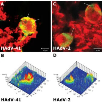 Fig. 3: kinetics of HAdV-2 infection in 293 cells. Newly synthesized  viral proteins revealed at 36 h of infection