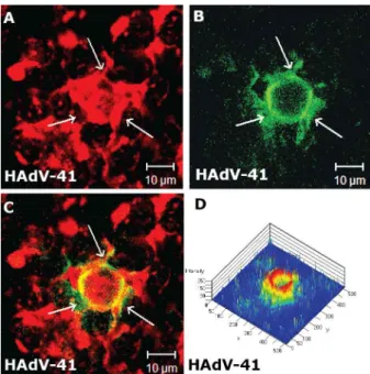 Fig. 6: HAdV-41 multiplication in 293 cells at 72 h of infection. A: intra-nuclear inclusion bodies revealed on orthogonal projection of x and y  axes