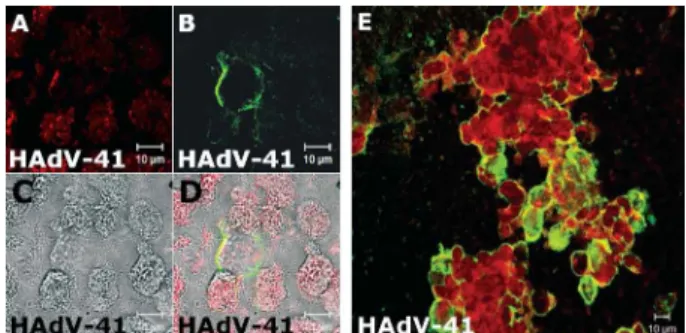 Fig. 11: kinetics of HAdV-41 infection in 293 cells. At 168 h of infec- infec-tion, the view of an infected cell that had detached from the  monolay-er, attached in another part of the culture and released viral proteins   or particles