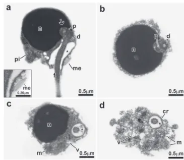Fig. 7. Spermatozoon of Micralestes acutidens. a, a-inset: