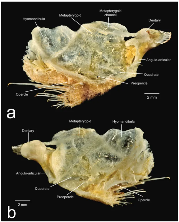 Fig. 8. Suspensorium of Spectracanthicus punctatissimus, MZUSP 108570, 78.2 mm SL. (a) external view and (b) internal  view