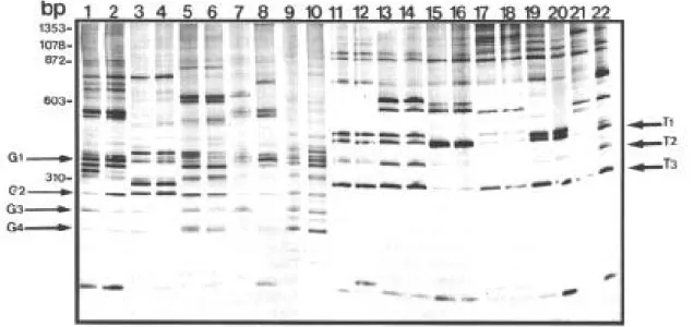 Fig. 4: silver-stained 4% polyacrylamide gel showing the LS-PCR amplification products obtained with primers NS1-ET1 and 1ng of DNA extracted