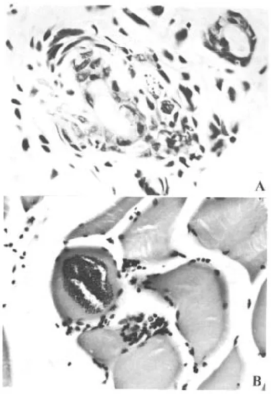 Fig. 2: nests of amastigotes in opossums experimentally infected with G-N strain at 80 days old