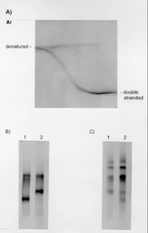 Fig. 3: denaturating gradient gel electrophoresis analysis of ribosomal polymerase chain reaction (PCR) products from  Try-panosoma cruzi  shows that two 18S types are present; A: