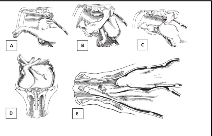 Figura 4 – Disposições fetais anormais. A – Apresentação anterior, posição dorsal com desvio da cabeça  para baixo