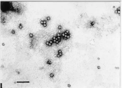 Fig. 1: electron micrograph of Triatoma virus obtained from ten T. infestans female dead insects (see Method 1)