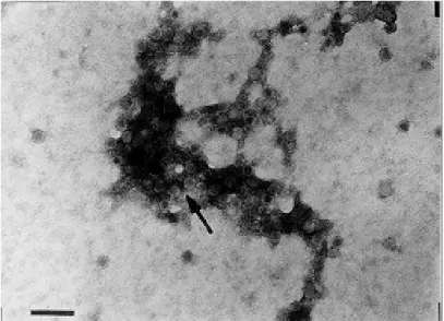 Fig. 4: electron micrograph of Triatoma virus obtained from NIV T. infestans dry button feces (see Method 4).The arrow indicates viral particles