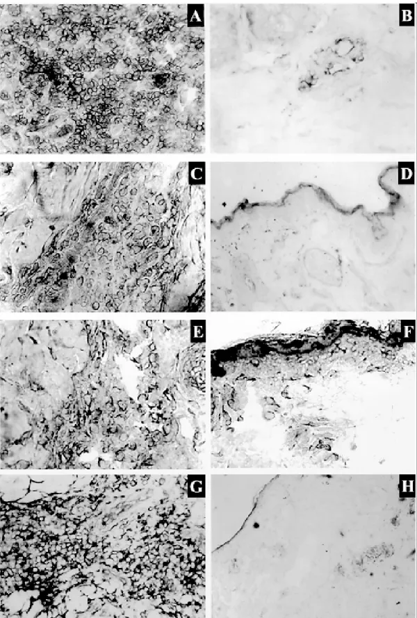 Fig. 2: cell populations in cutaneous leishmaniasis of Leishmania (L.) amazonensis-infected Macaca mulatta