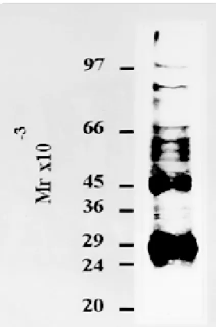Fig. 4: proteins synthesized by the parasite cell-free system.