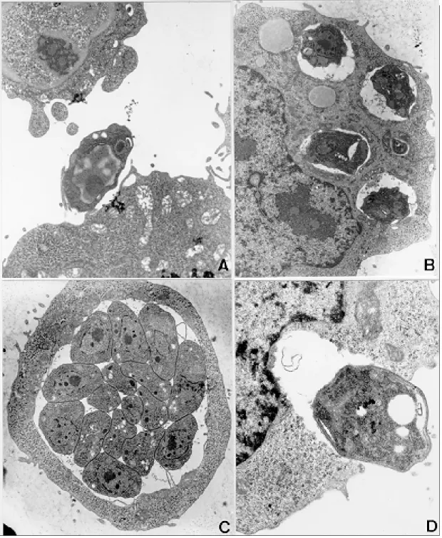 Fig. 1: TG180 sarcoma murine cells after in vivo infection by RH strain of Toxoplasma gondii